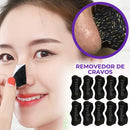 Máscara para Cravos - Elimine Cravos do Nariz sem Dor!