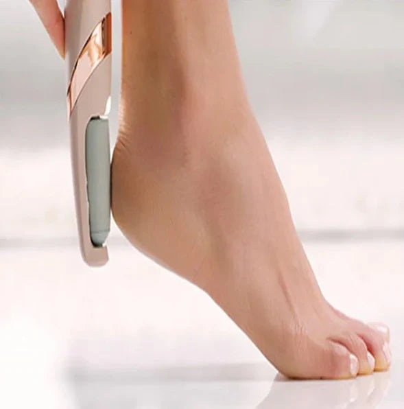 SoftFeet™ - Removedor de Calos Elétrico