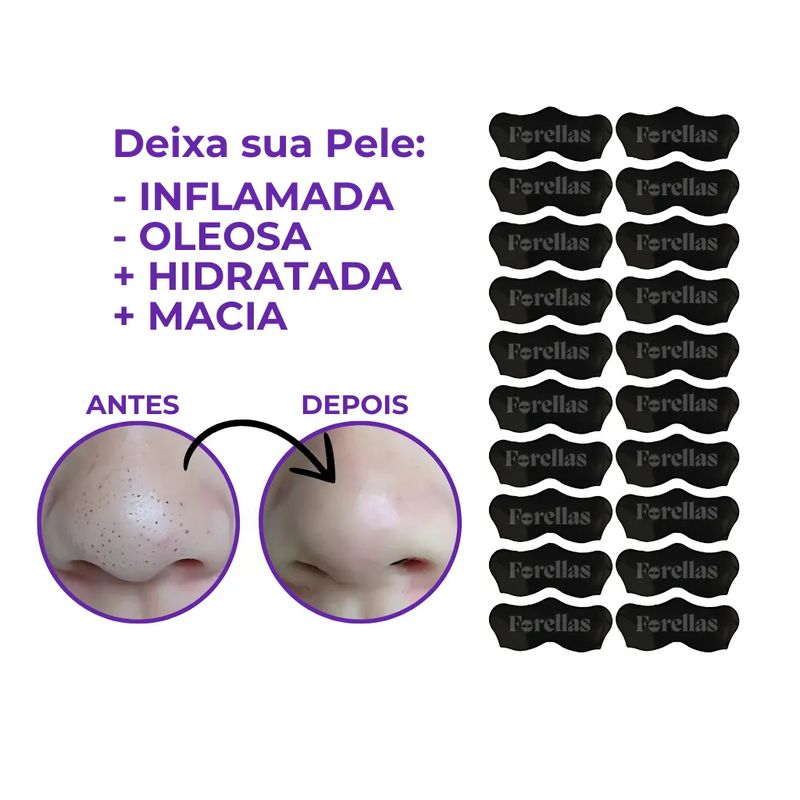 Máscara para Cravos - Elimine Cravos do Nariz sem Dor!