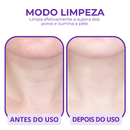 Massageador Facial LED - Rejuvenesça a Pele em Minutos!