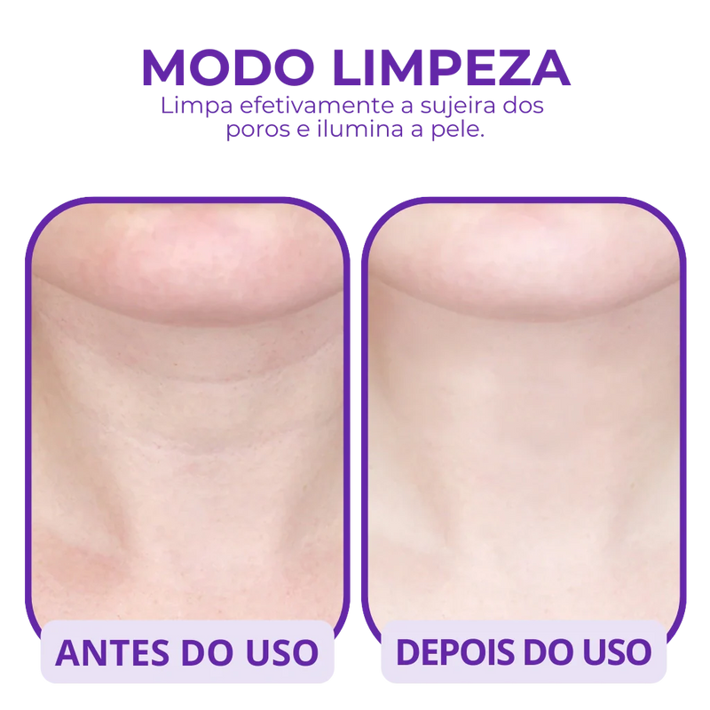 Massageador Facial LED - Rejuvenesça a Pele em Minutos!