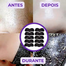 Máscara para Cravos - Elimine Cravos do Nariz sem Dor!