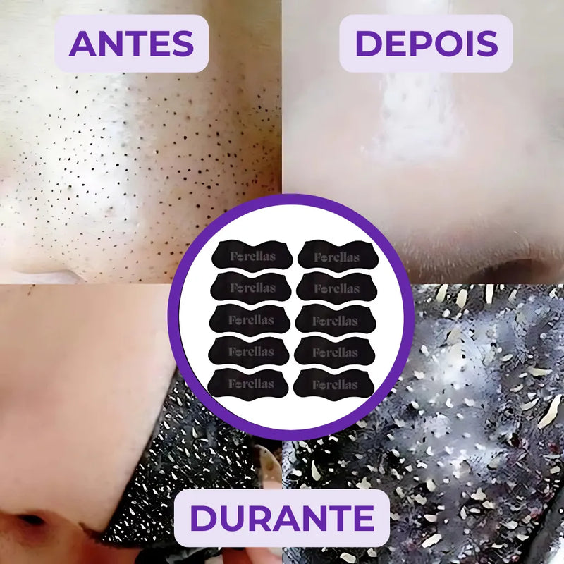 Máscara para Cravos - Elimine Cravos do Nariz sem Dor!