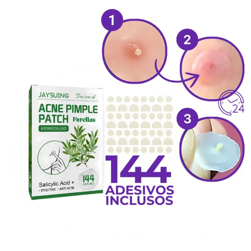 Adesivo Antiacne - Elimine Espinhas sem Marcas em 1 Dia!