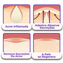 Adesivo Antiacne - Elimine Espinhas sem Marcas em 1 Dia!