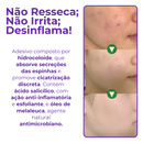 Adesivo Antiacne - Elimine Espinhas sem Marcas em 1 Dia!