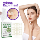 Adesivo Antiacne - Elimine Espinhas sem Marcas em 1 Dia!
