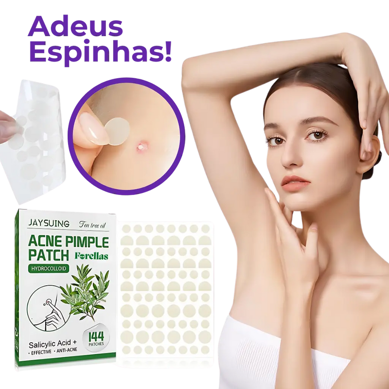 Adesivo Antiacne - Elimine Espinhas sem Marcas em 1 Dia!