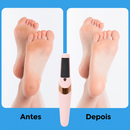 SoftFeet™ - Removedor de Calos Elétrico